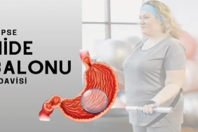 Mide Balonu Fiyatları