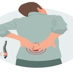 Bel Fıtığı Ameliyatı Ne Zaman Gerekir? Uzmanlar Hangi Durumlarda Cerrahiyi Öneriyor?